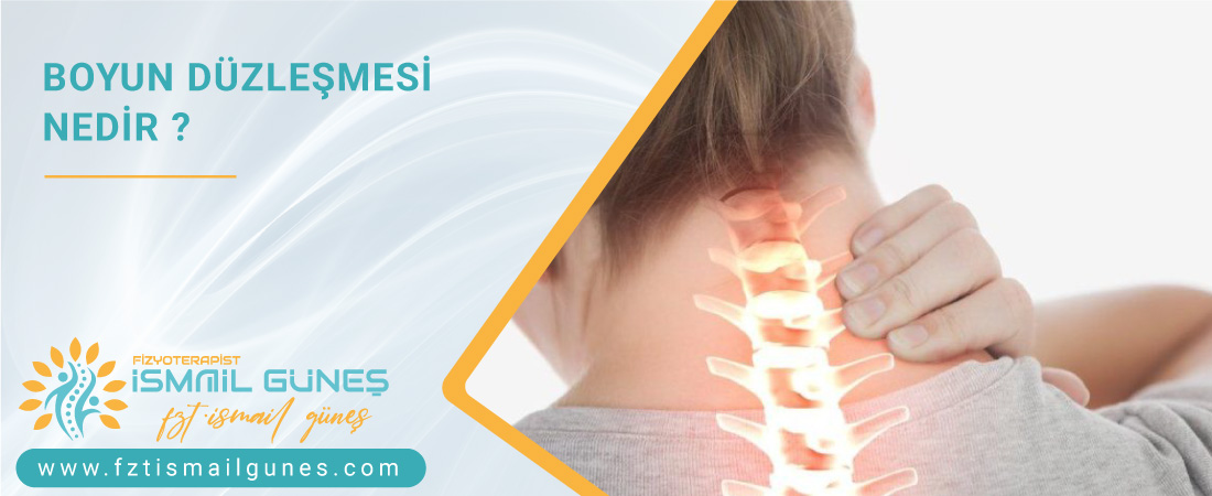 Boyun Düzleşmesi Nedir ?